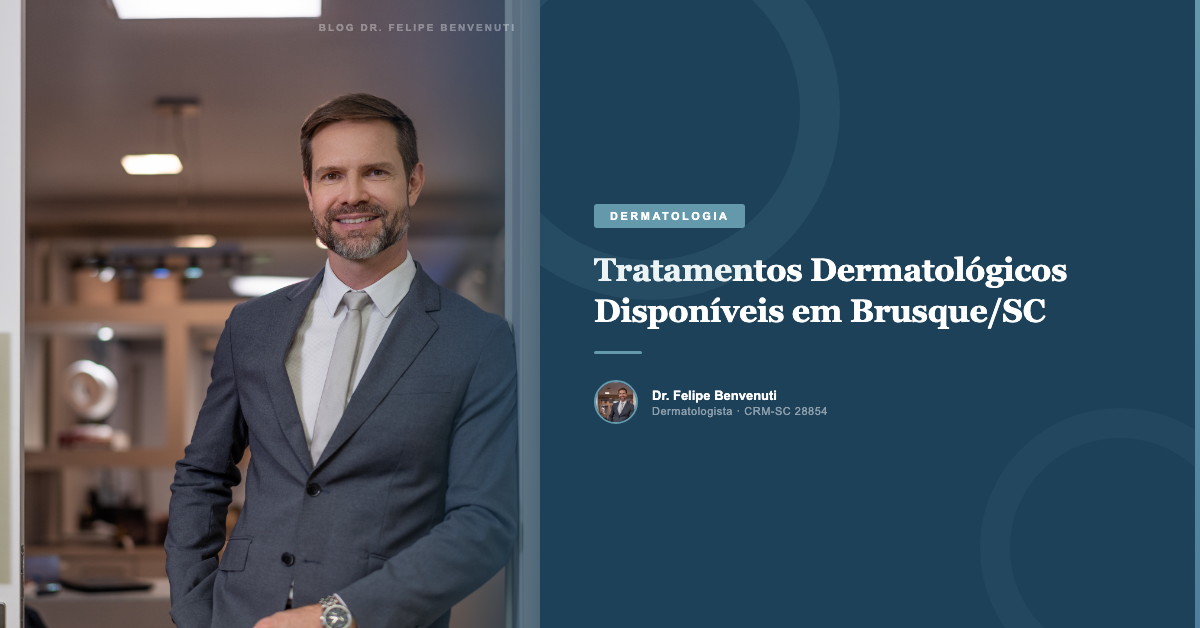 Tratamentos Dermatológicos Disponíveis em Brusque/SC