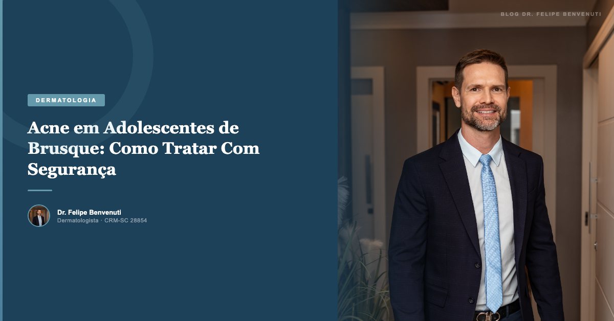 Acne em Adolescentes de Brusque: Como Tratar Com Segurança