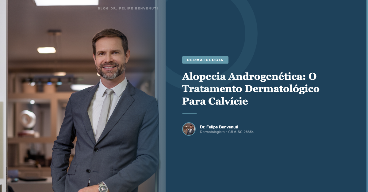 Alopecia Androgenética: O Tratamento Dermatológico Para Calvície