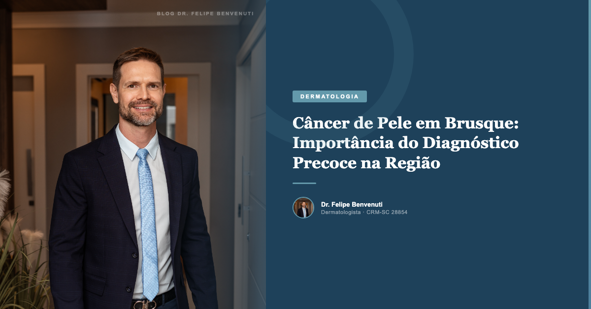 Câncer de Pele em Brusque: Importância do Diagnóstico Precoce na Região