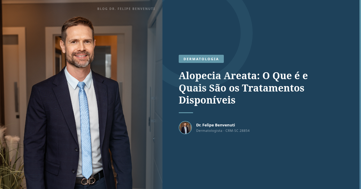 Alopecia Areata: O Que é e Quais São os Tratamentos Disponíveis