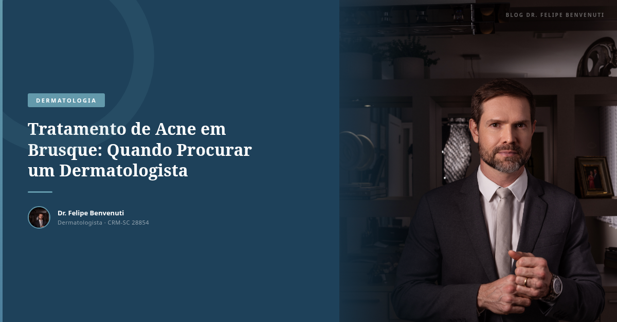 Tratamento de Acne em Brusque: Quando Procurar um Dermatologista