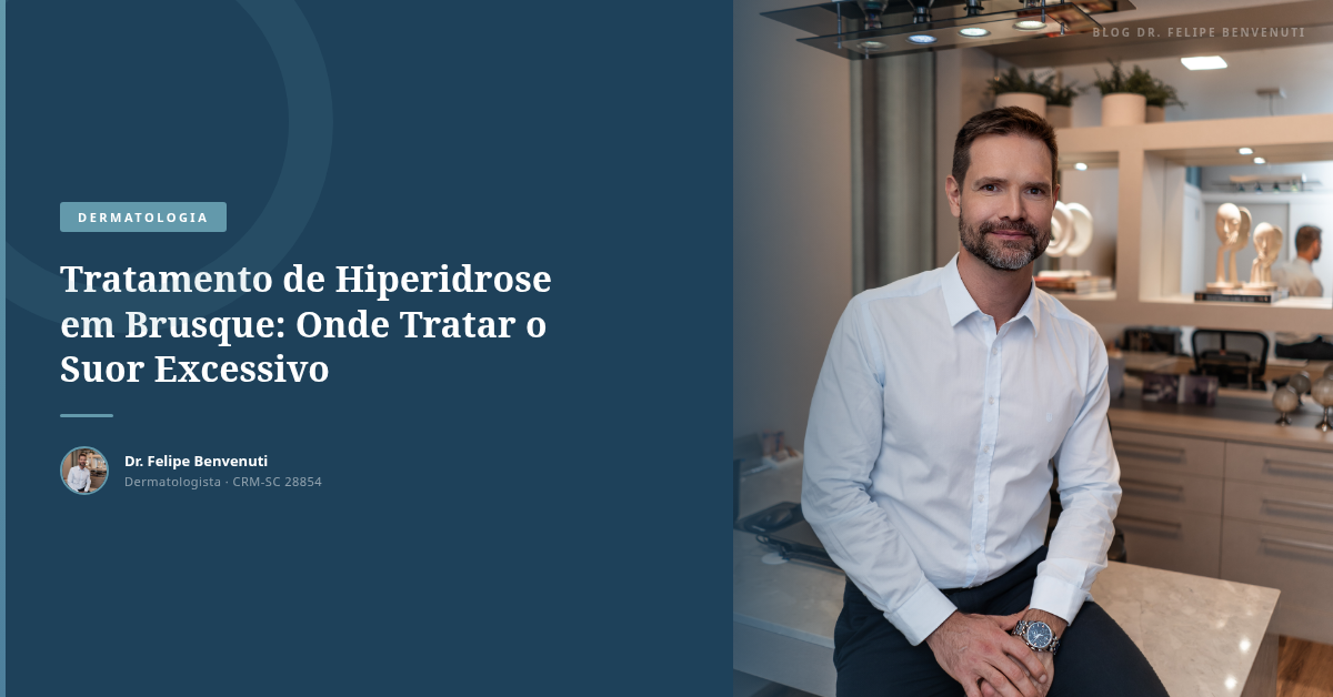 Tratamento de Hiperidrose em Brusque: Onde Tratar o Suor Excessivo