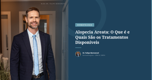 Alopecia Areata: O Que é e Quais São os Tratamentos Disponíveis