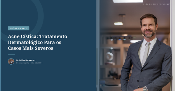 Acne Cística: Tratamento Dermatológico Para os Casos Mais Severos