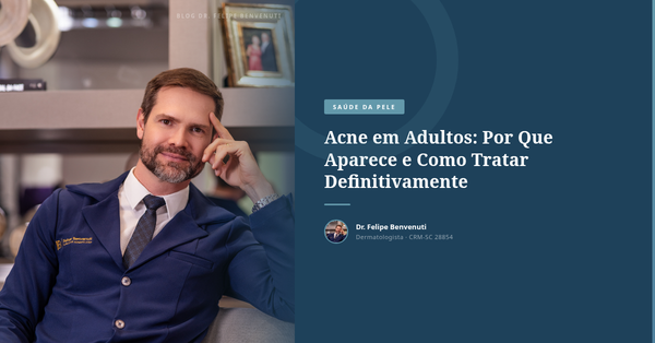 Acne em Adultos: Por Que Aparece e Como Tratar Definitivamente
