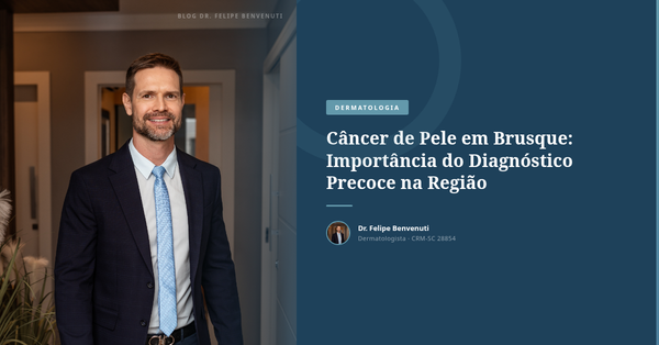 Câncer de Pele em Brusque: Importância do Diagnóstico Precoce na Região