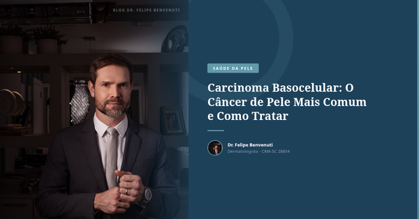 Carcinoma Basocelular: O Câncer de Pele Mais Comum e Como Tratar