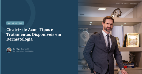 Cicatriz de Acne: Tipos e Tratamentos Disponíveis em Dermatologia