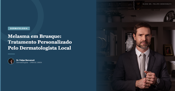 Melasma em Brusque: Tratamento Personalizado Pelo Dermatologista Local