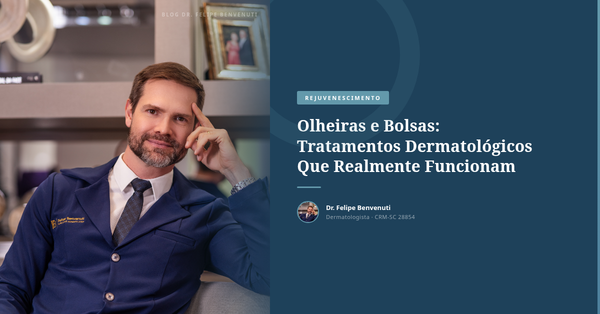 Olheiras e Bolsas: Tratamentos Dermatológicos Que Realmente Funcionam