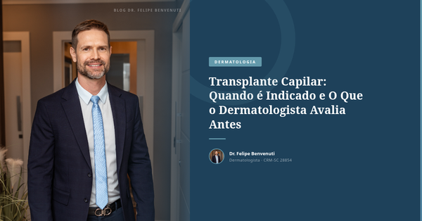 Transplante Capilar: Quando é Indicado e O Que o Dermatologista Avalia Antes