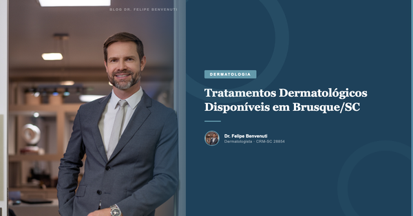 Tratamentos Dermatológicos Disponíveis em Brusque/SC