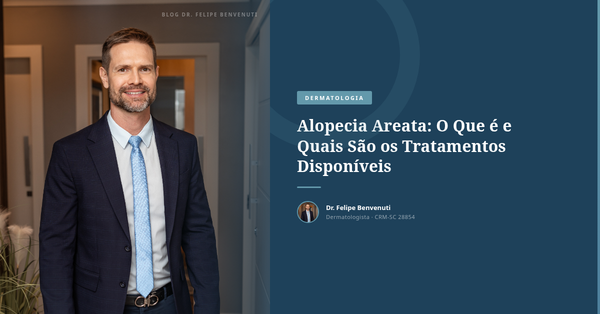 Alopecia Areata: O Que é e Quais São os Tratamentos Disponíveis