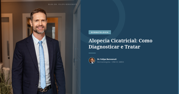 Alopecia Cicatricial: Como Diagnosticar e Tratar